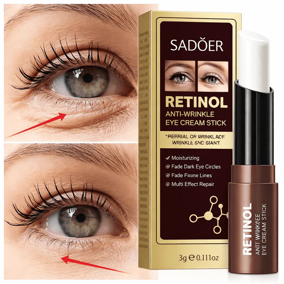 SADOER Retinol - Despídete de las Ojeras y Bolsas en Minutos